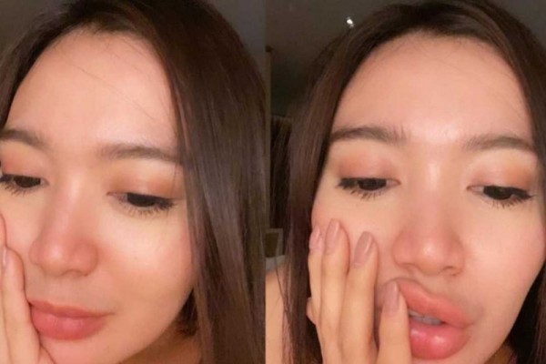 Menor di Panggung, 9 Gaya Selfie Penyanyi Dangdut tanpa Makeup, Pede!