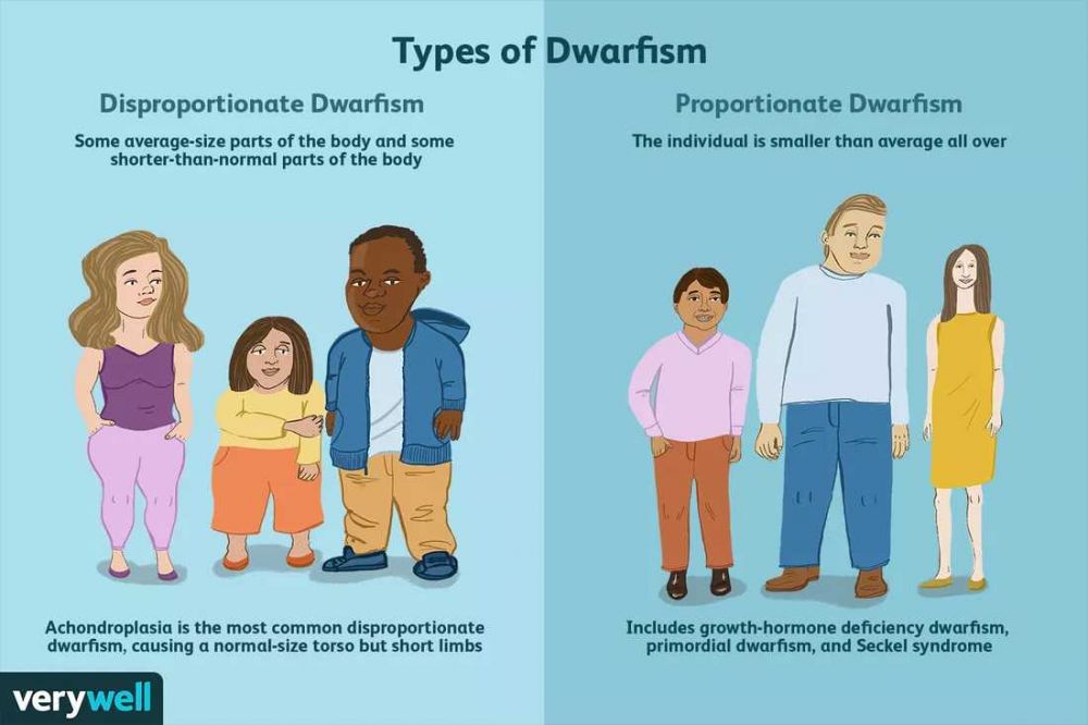 Dwarfisme: Jenis, Penyebab, Gejala, Diagnosis, Pengobatan