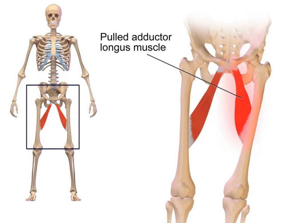 groin-strain-penyebab-gejala-dan-pengobatan