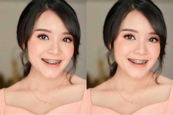 Jarang Disorot, 9 Potret Fati Indraloka Istri Babe Cabita yang Menawan