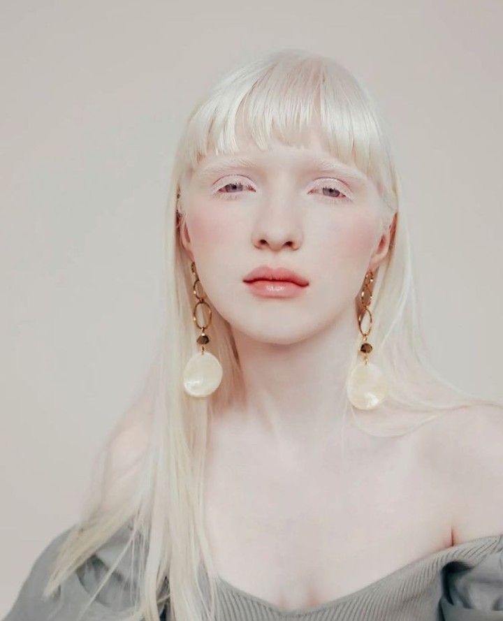10 Potret Nastya Zhidkova Model Albino Populer Asal Ukraina