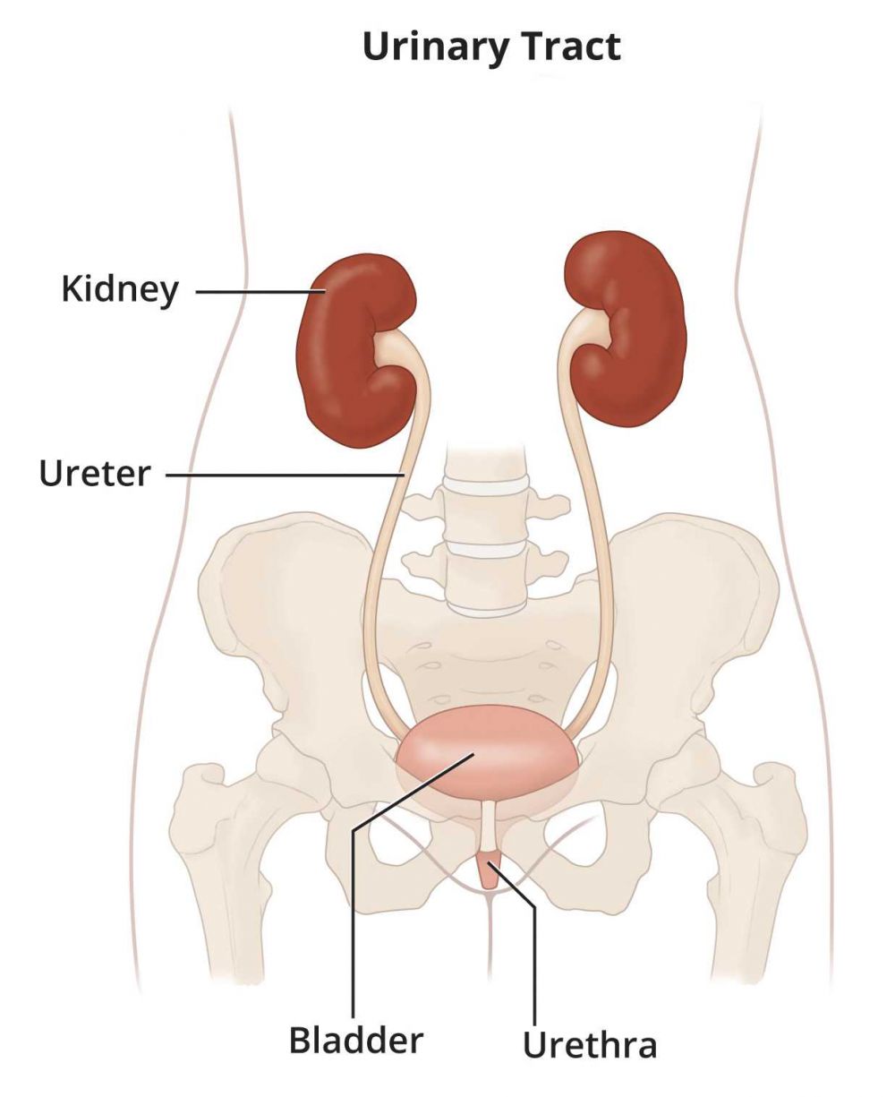 Kondisi Ginjal Bengkak akibat Penumpukan Urine, Kenali Hidronefrosis