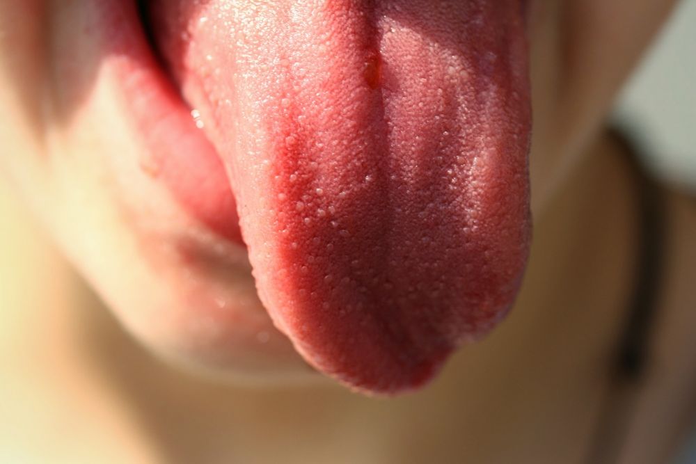 7 Penyebab Gigi Tonggos, Bisakah Dihindari?