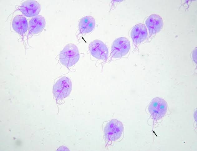 Mengenal Giardia lamblia, Parasit yang  Menginfeksi Sistem Pencernaan