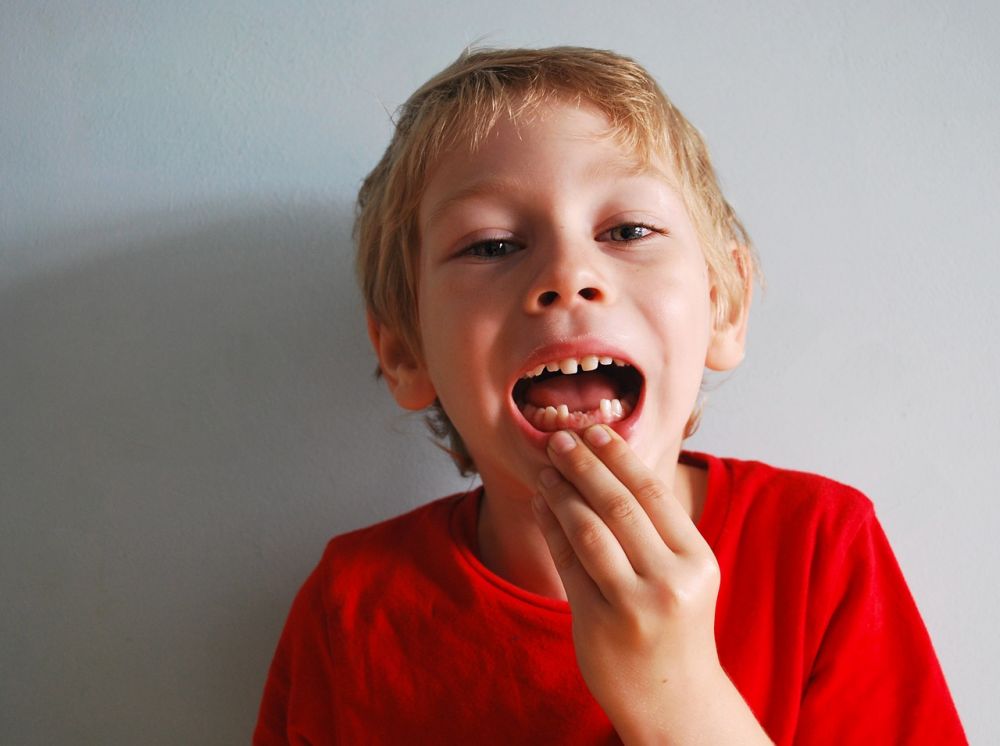 5 Mitos seputar Gigi Anak yang Harus Diketahui Orangtua, Cek Faktanya!