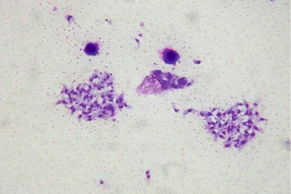 5 Komplikasi Kesehatan yang Berkaitan dengan Parasit Toxoplasma Gondii