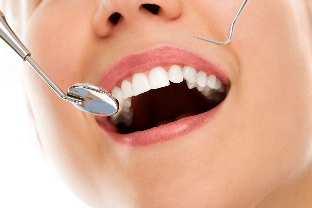 5 Manfaat Rutin Flossing Gigi, Hilangkan Sisa Makanan hingga Bakteri 