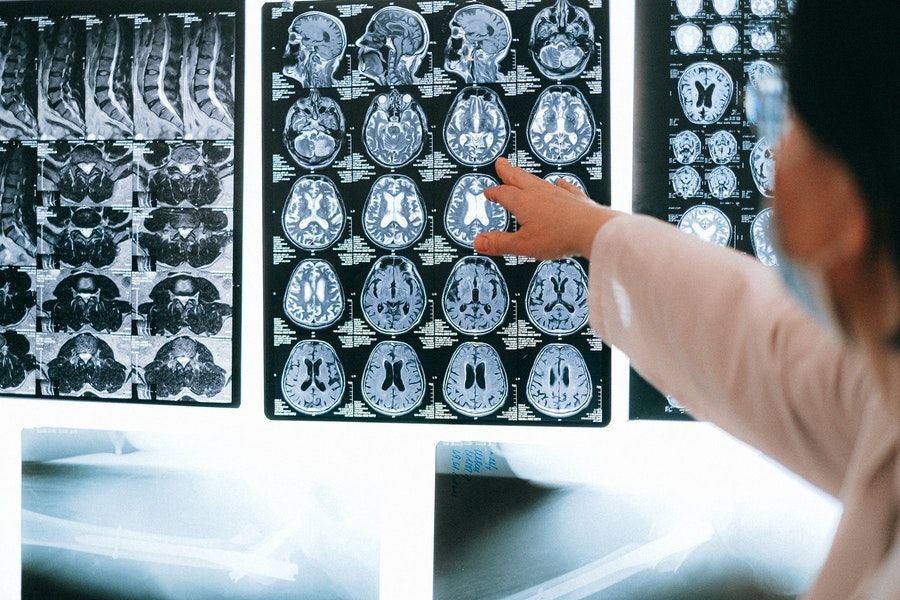 6 Fakta Pemeriksaan MRI Jantung, Pasien Akan Diberi Headphone!
