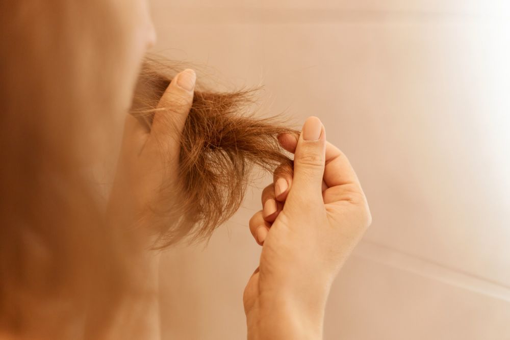 Kenali 5 Masalah Rambut Beserta Kondisi Kesehatan yang Mendasarinya