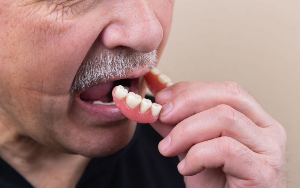 Bahaya Pasang Kawat Gigi Sembarangan 