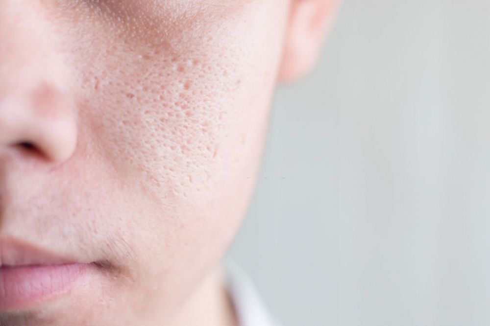 5 Manfaat Air Dingin untuk Wajah, Bisa Hemat Budget Skincare