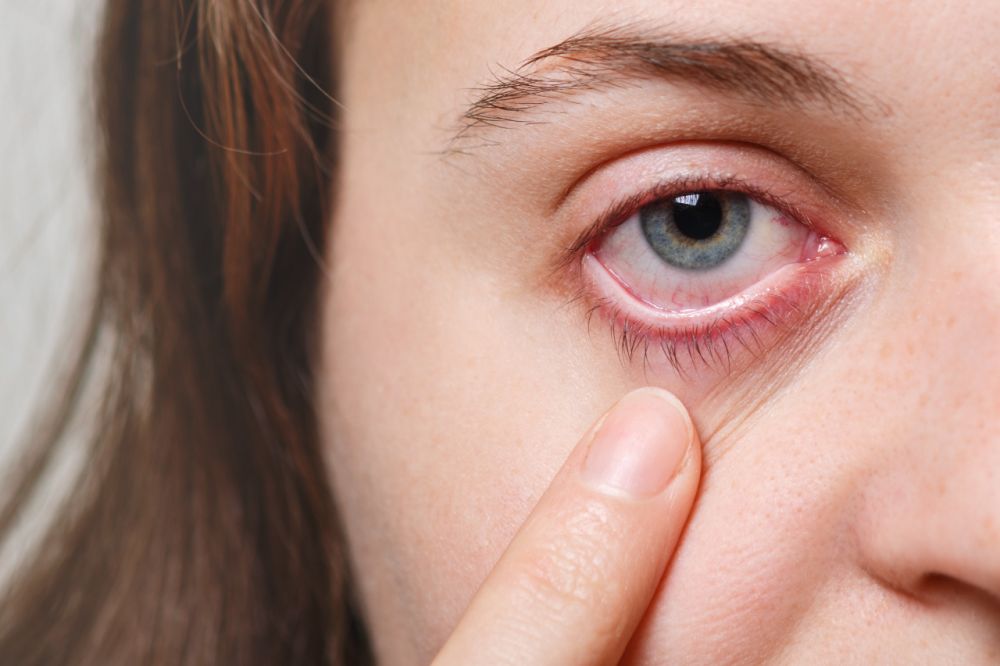 5 Hal yang Terjadi Jika Kamu Keseringan Pakai Obat Tetes Mata