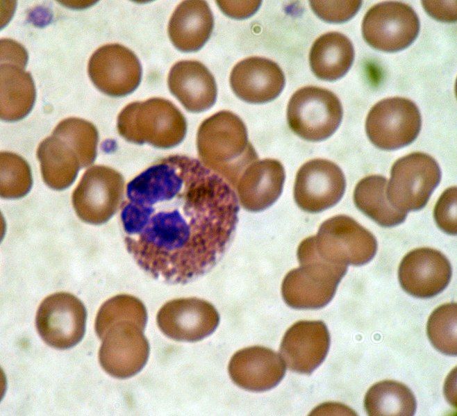 5 Jenis Sel Darah Putih dan Fungsinya bagi Tubuh