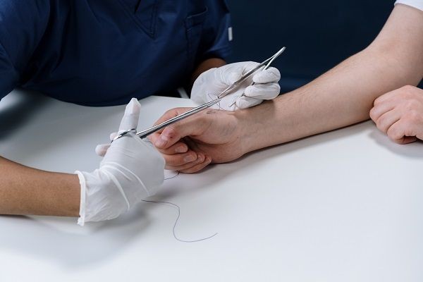 5 Fakta Benang Operasi, Punya Pengaruh Besar di Dunia Medis