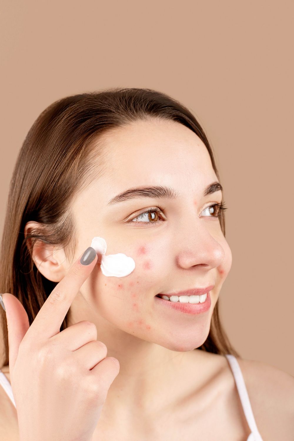 Skincare Viral Ampuh Atasi Jerawat, Dark Spot dan Bikin Kulit Cerah 