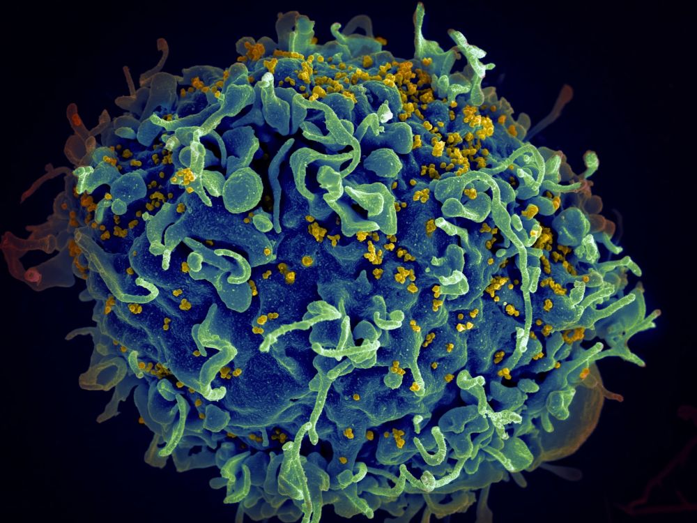 Gambar Virus HIV