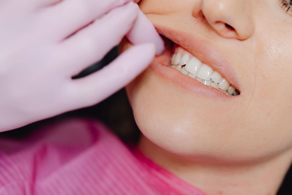 5 Alasan Penting untuk Merapikan Gigi yang Berantakan