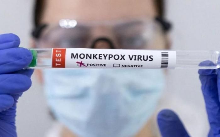 Dinkes Jabar Pastikan Cacar Warga Sumedang Bukan Monkeypox
