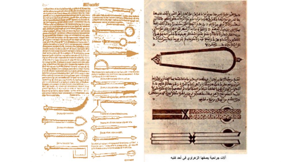 Mengenal 5 Fakta AlZahrawi, Bapak dari Ilmu Bedah Modern