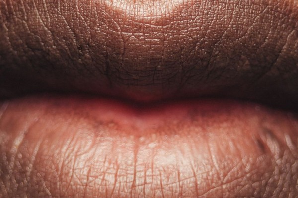 5 Tips Mencegah Bibir Menjadi Kehitaman dan Kering