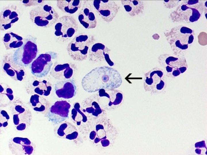 Mengenal Bakteri Pemakan Otak Manusia, Naegleria Fowleri