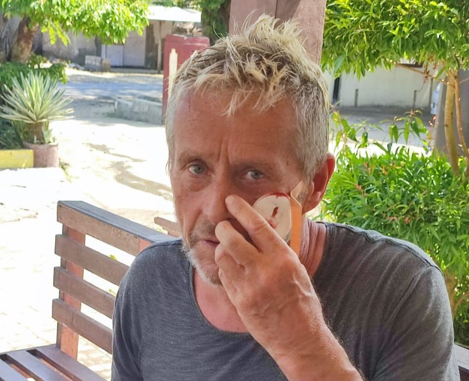 Seorang Turis asal Inggris Diduga Jadi Korban Penganiayaan di Lombok