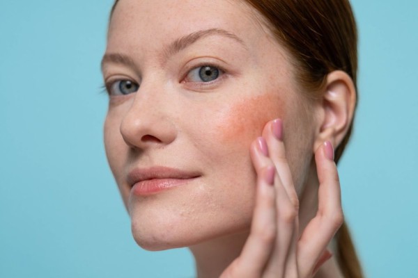 5 Cara Mengatasi Blush On yang Terlalu Menor, Super Cepat!