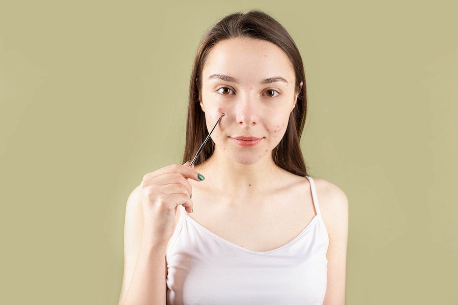 5 Cara Menghapus Komedo di Hidung dengan Baby Oil, Anti Ribet!