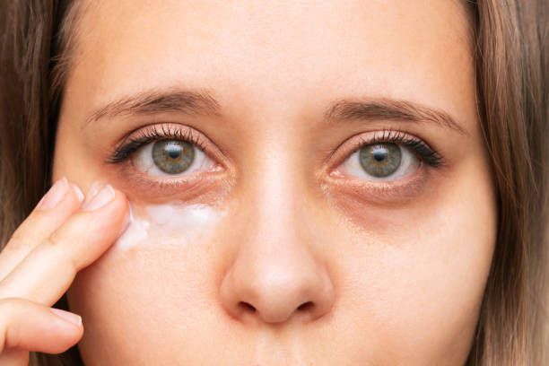 6 Tips Menyamarkan Lingkaran Gelap di Bawah Mata dengan Makeup