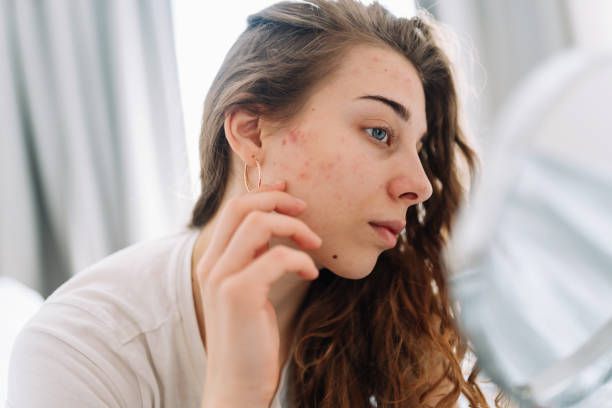 6 Alasan Kenapa Penggunaan Skincare Malam Sangat Penting