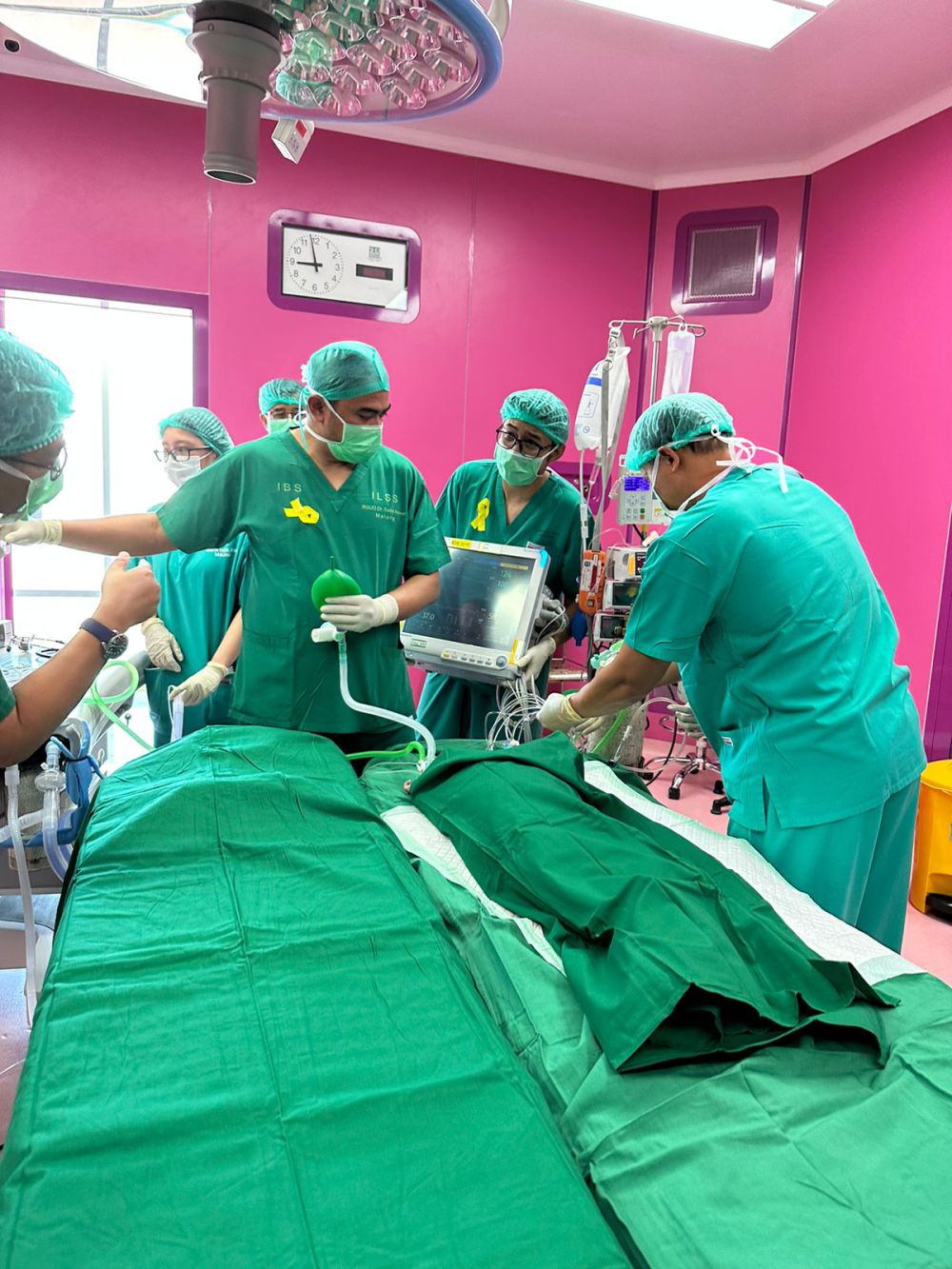Operasi Pemisahan Bayi Kembar Siam Pertama di RSSA Malang Sukses