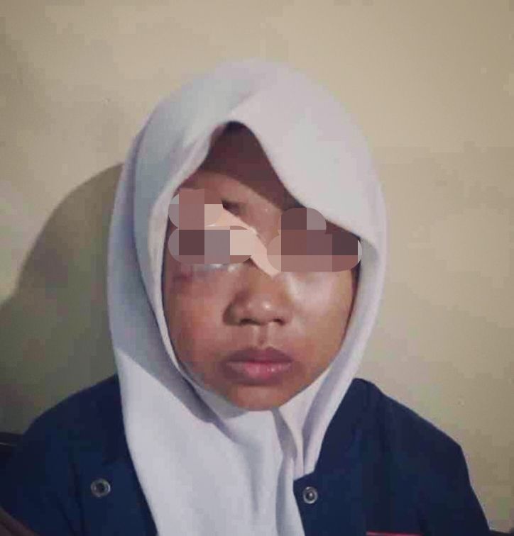 Viral Siswi SMK di Pasuruan Dirampok hingga Wajahnya Babak Belur