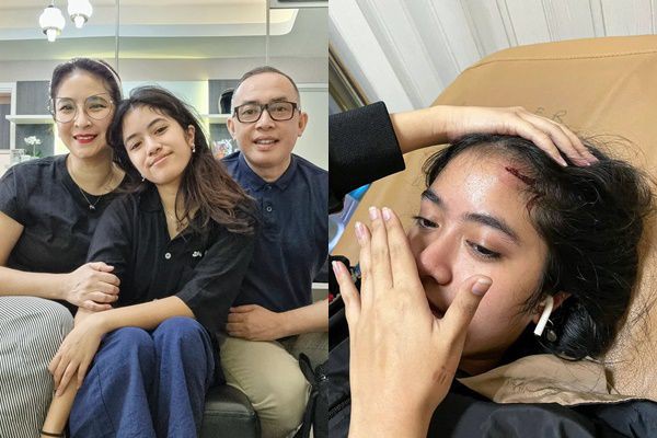 7 Potret Kondisi Anak Novita Angie Usai Jatuh di Eskalator