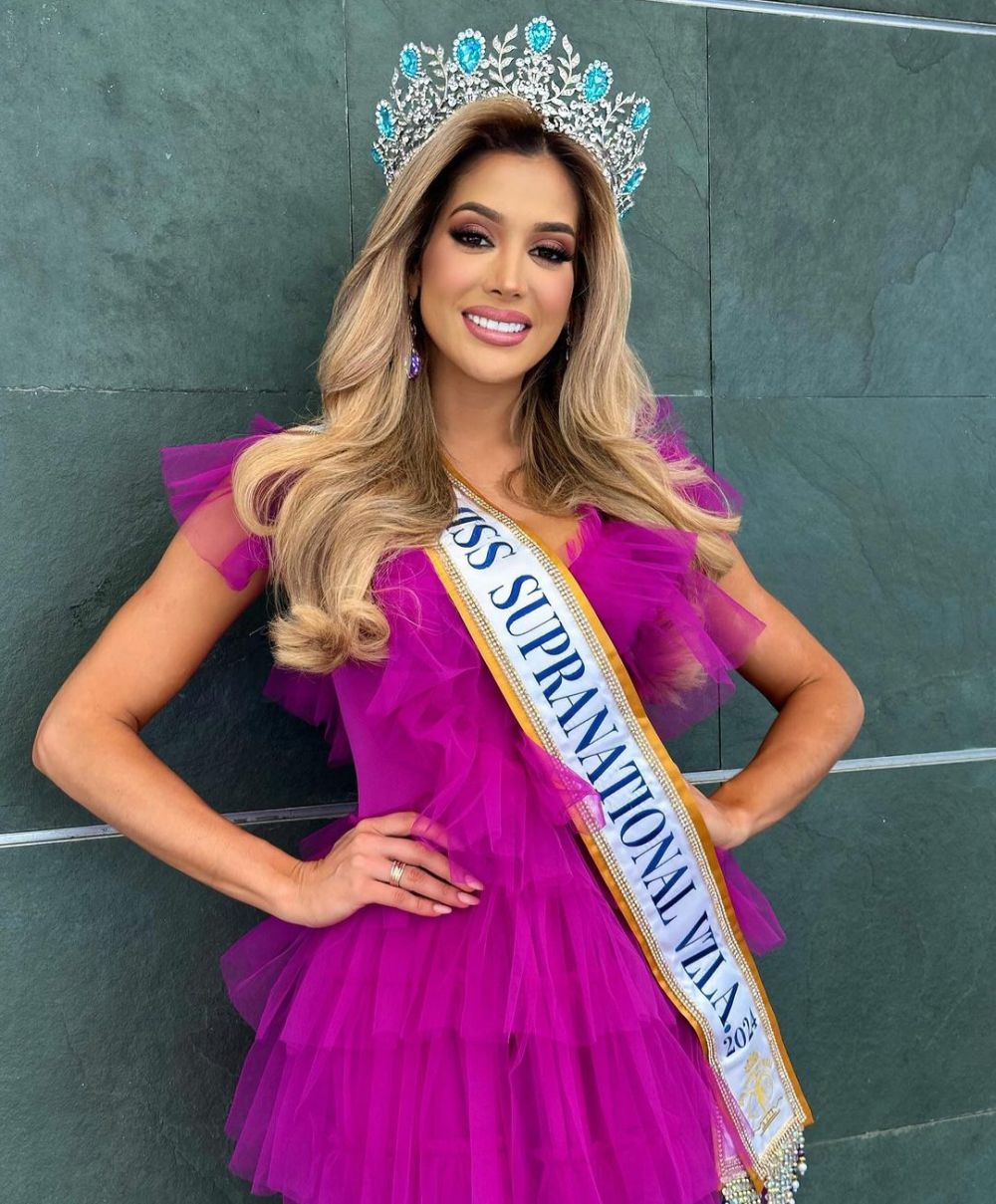 7 Potret Rossana Fiorini Miss Supranational Venezuela 2024