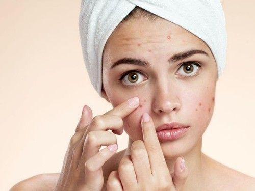 Kenali formula perawatan kulit ini untuk mencegah masalah wajah