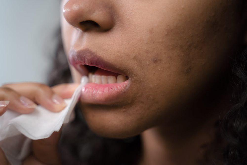 5 Cara Melakukan Scrub Bibir agar Hasilnya Optimal