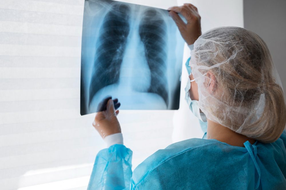 Mengenal Penyakit TBC, Cara Mencegah dan Menanganinya