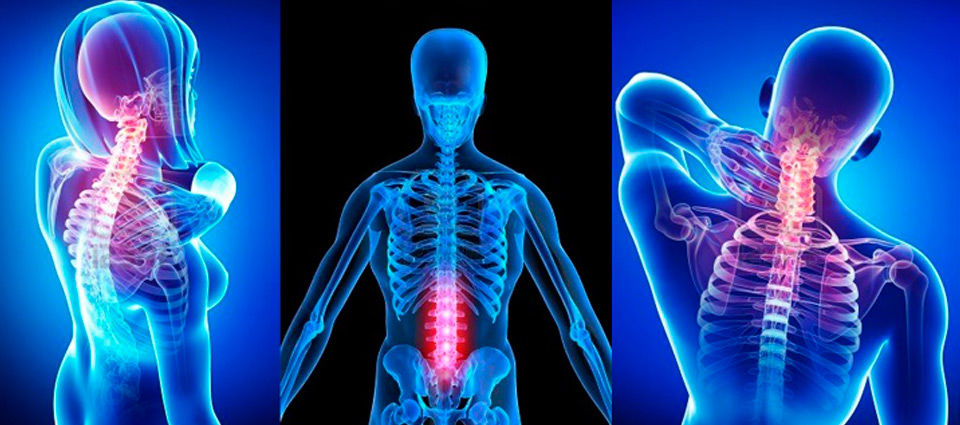 11 Fakta Terapi Chiropractic, Sangat Mencengangkan!