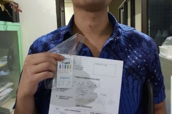 Konsumsi Kokain Pakai Uang Dollar, Begini Sosok Richard