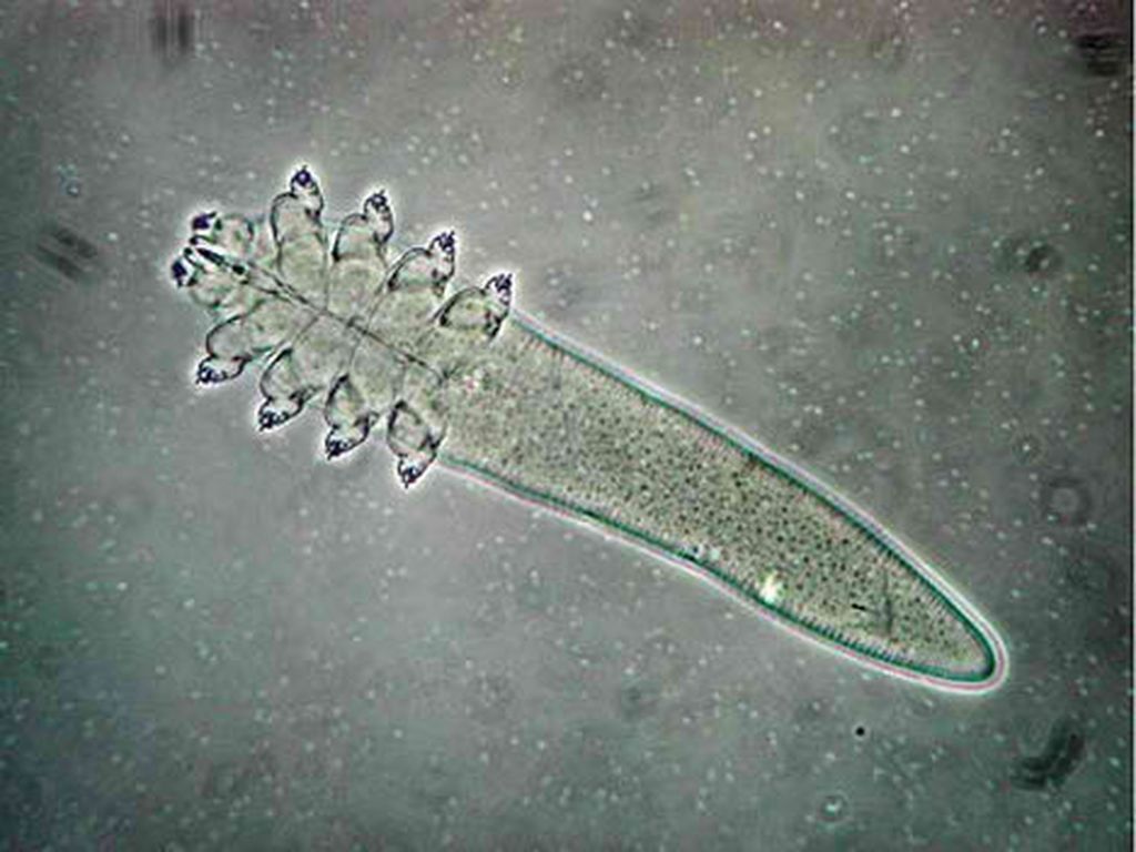 Клещ демодекс. Железница угревая микроскоп. Клещ Demodex folliculorum микроскоп.