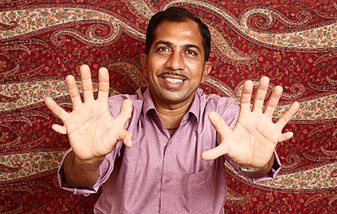 Inilah Daftar 10 Orang yang Punya Bentuk Anggota Tubuh Tak Biasa
