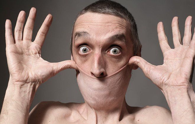 Inilah Daftar 10 Orang yang Punya Bentuk Anggota Tubuh Tak Biasa