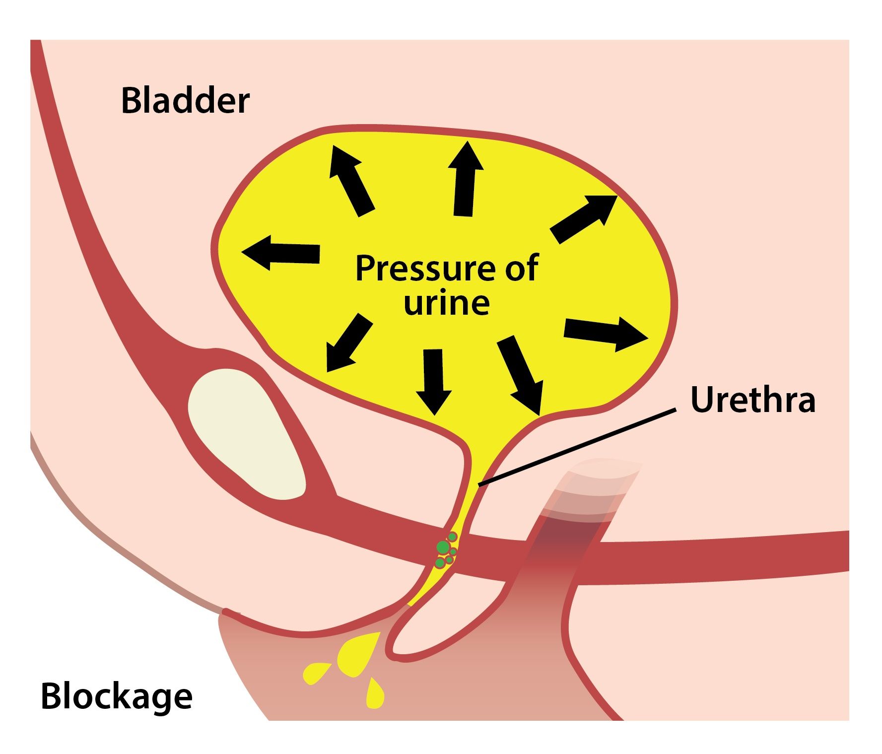 Jurnal Sistem Urinaria : Anatomi Sistem Urinaria Ppt ...