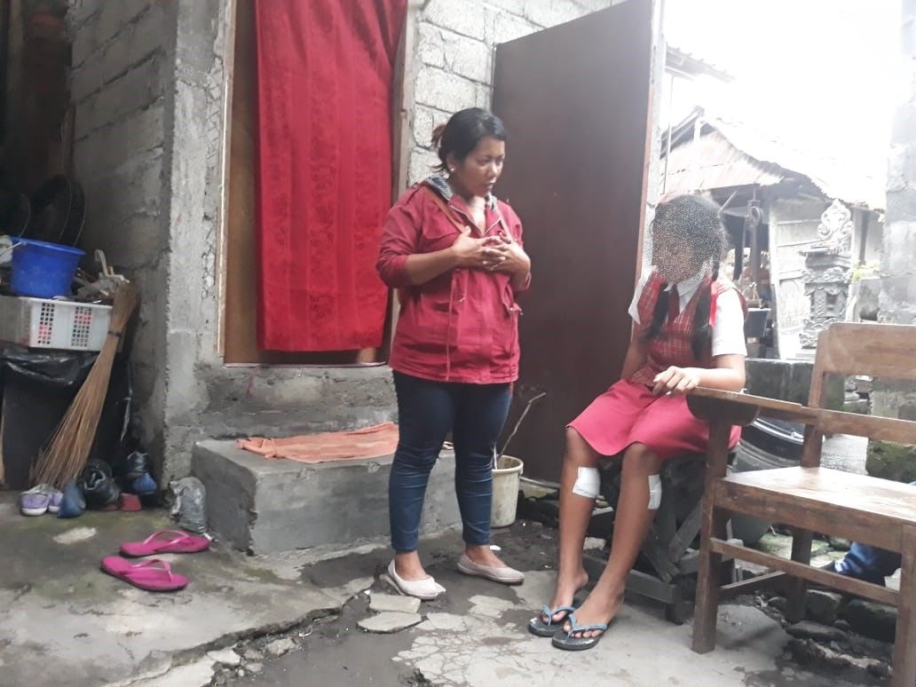 Betis Gadis Kelas 6 SD Disayat Pria Misterius di Denpasar