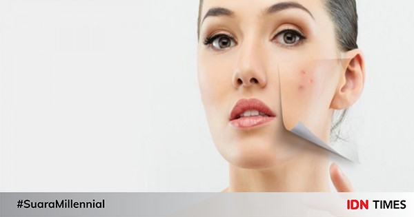 8 Cara Menghilangkan Flek Hitam di Wajah