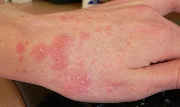10 Manfaat Tak Terduga Vitamin C untuk Kesehatanmu