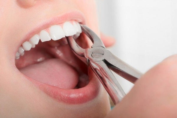 9 Perawatan Gigi Saat Puasa di Bulan Ramadan yang Dibolehkan dan Tidak