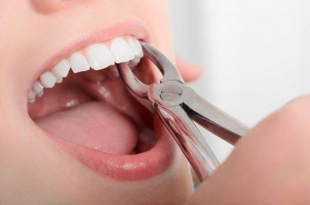 Mahasiswa USU Olah Bawang Batak Jadi Gel Atasi Peradangan di Gigi