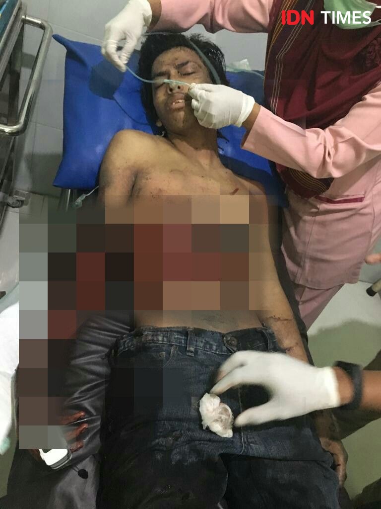 Bom di Kartasura, Kapoda Jateng: Korban adalah Pelaku Tunggal