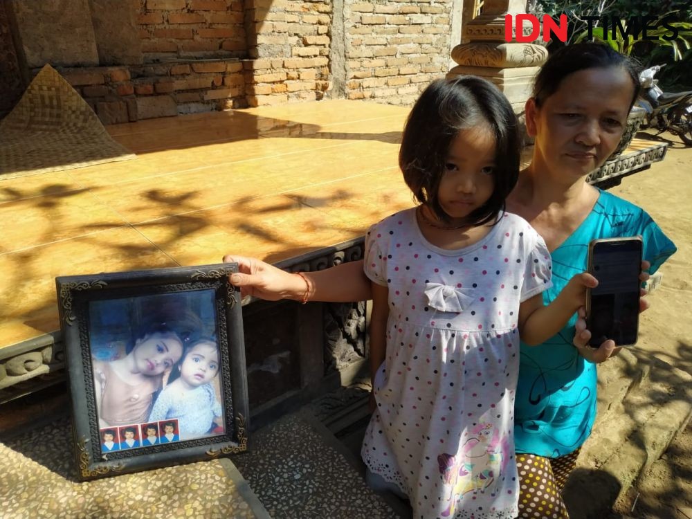 Kisah Bocah Kakak-Adik di Bali Alami Gangguan Lever Sejak Usia 5 Tahun